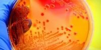 Microbiology